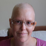 Deirdré, bald from chemo
